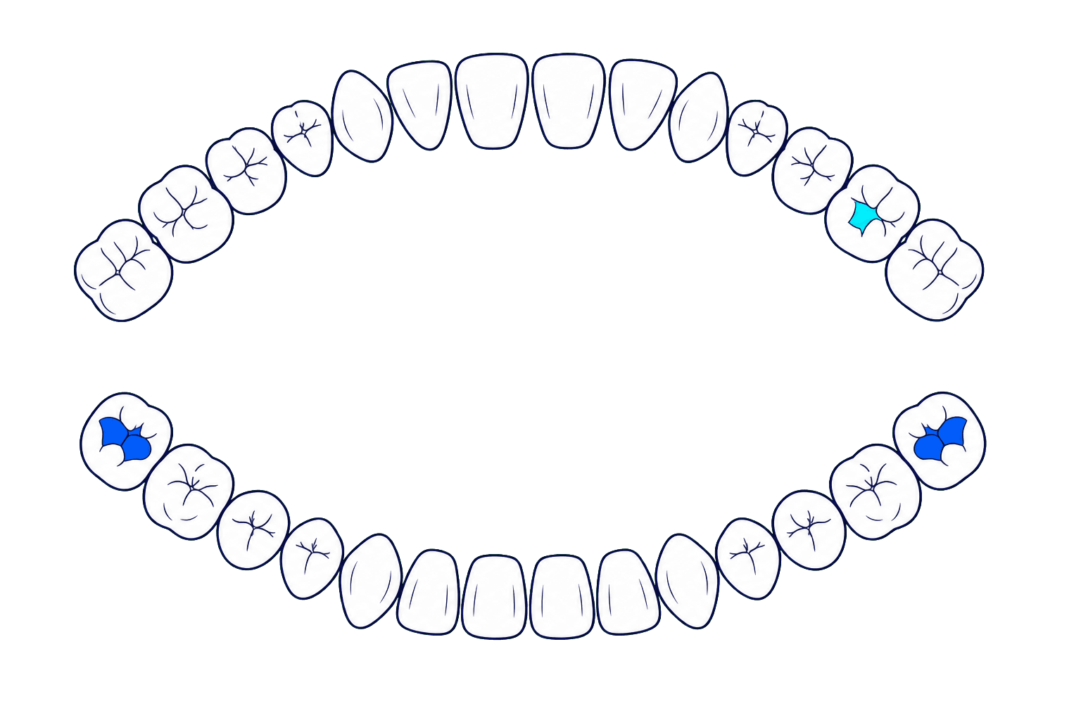 Vista demostrativa de un odontograma adulto con dos arcos dentales
